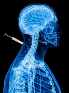 Cervical Medial Branch Block