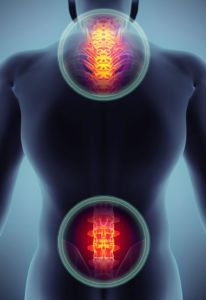 Cervical and Lumbar Radiculopathy