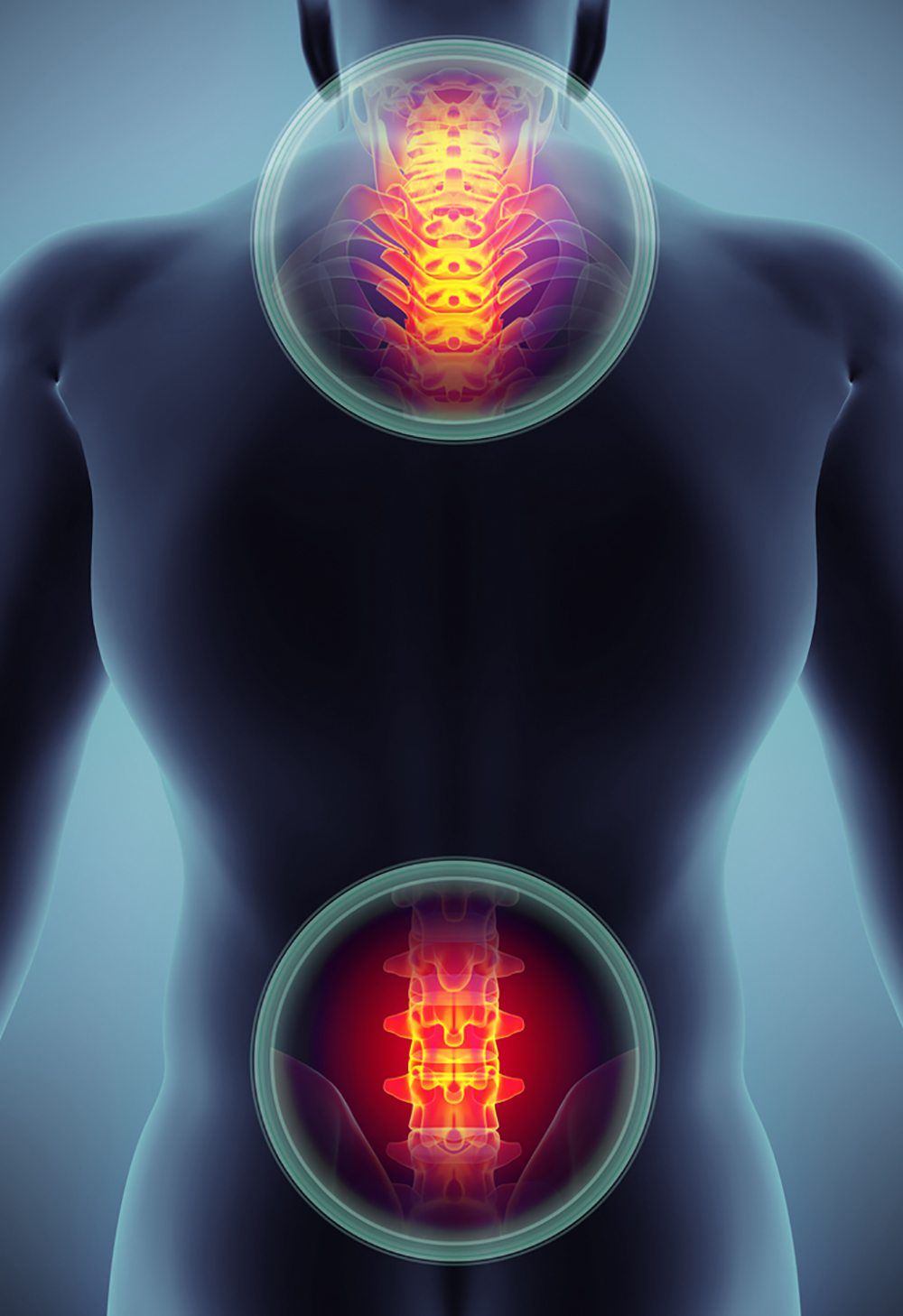 Lumbar Back Pain With Radiculopathy Affecting Right Lower Extremity