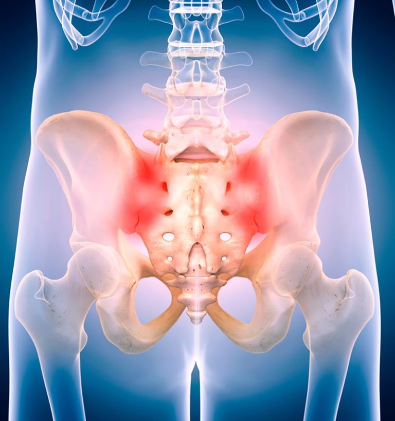 sacroiliac-joint-injection-chalfont-pain-management-delaware-valley