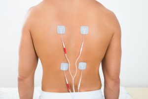 Spinal Cord Stimulator Trial