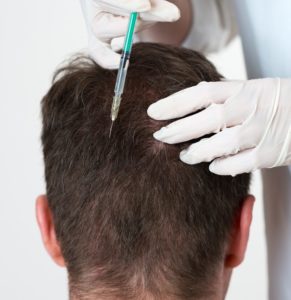 Occipital Nerve Block