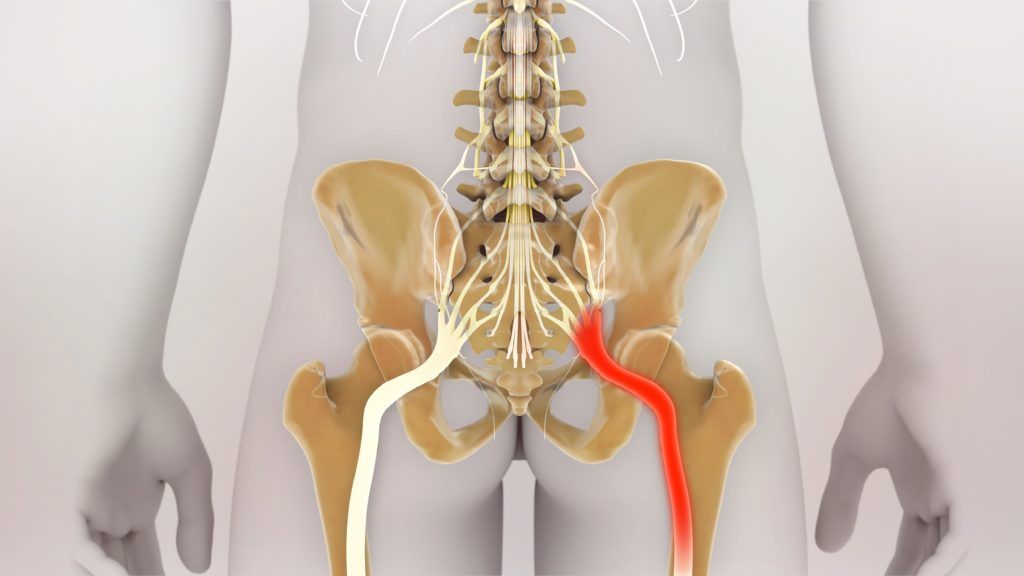 the-different-types-of-sciatic-nerve-pain-delaware-valley-pain