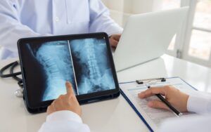 Herniated Disc X-Ray