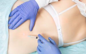 Woman receiving a nerve block